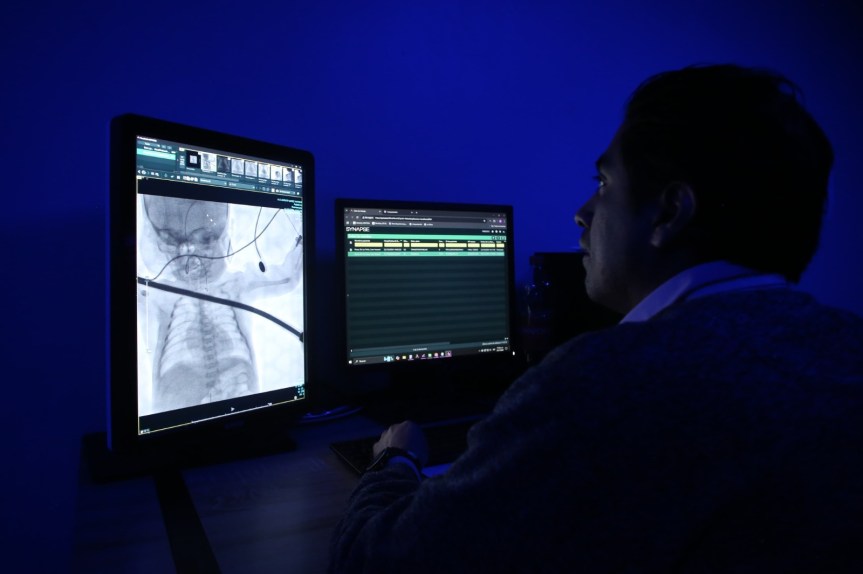 Salvan la vida de recién nacido con grave&nbsp;cardiopatía.