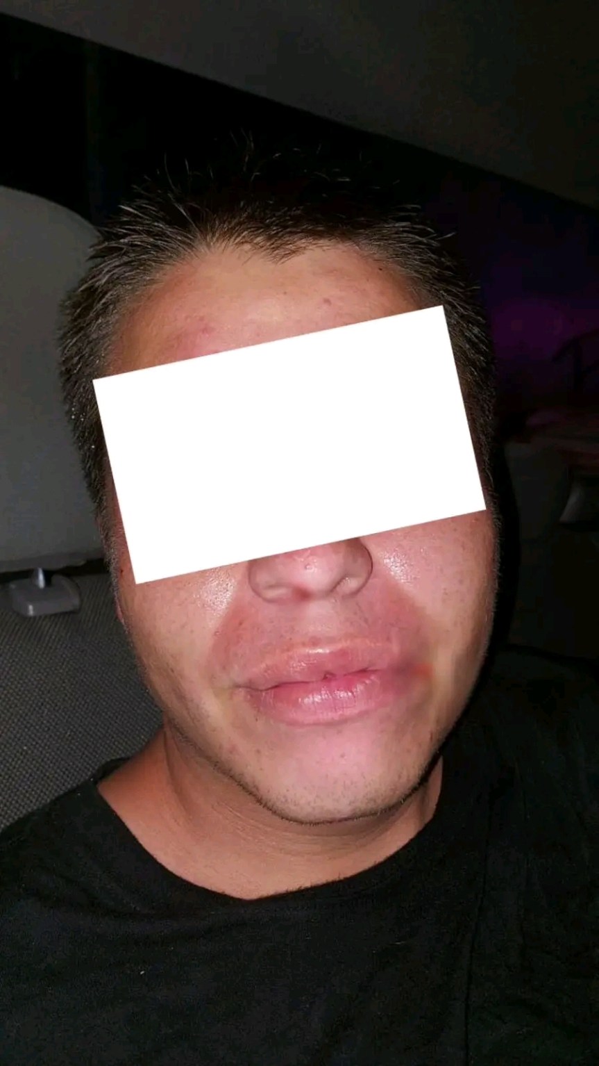 Detienen a presunto ladrón tras persecución en&nbsp;Tetlán.